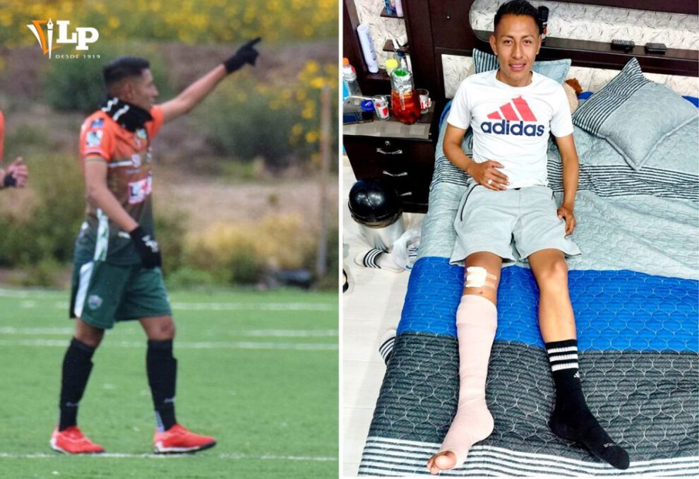 Harold Calle en proceso de recuperación tras fractura