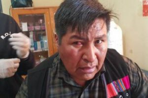 Marlene Calata internada en el Hospital de la Mujer