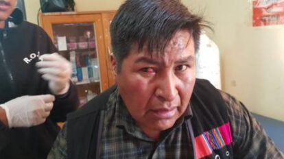 Marlene Calata internada en el Hospital de la Mujer