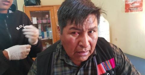 Marlene Calata internada en el Hospital de la Mujer