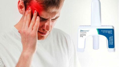 Zavzpret, aerosol nasal para aliviar la migraña