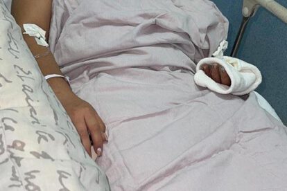 Feminicidio en Cochabamba: Matilde Jiménez tras ser agredida con ácido