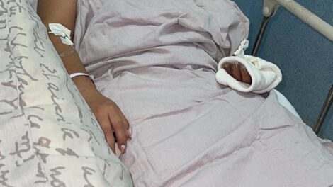 Feminicidio en Cochabamba: Matilde Jiménez tras ser agredida con ácido