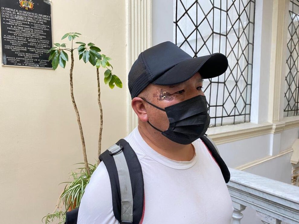 Cyborg Kanashiro propone transmitir conocimiento judicial a través de una papa