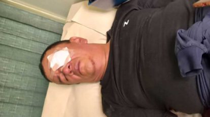 Profesor herido por la Policía en Roboré