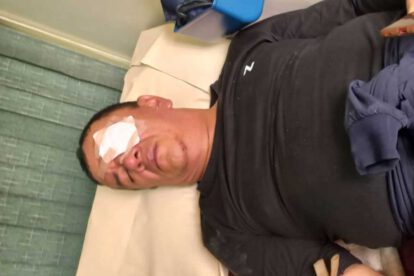 Profesor herido por la Policía en Roboré