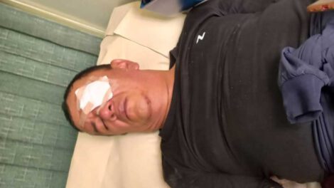 Profesor herido por la Policía en Roboré