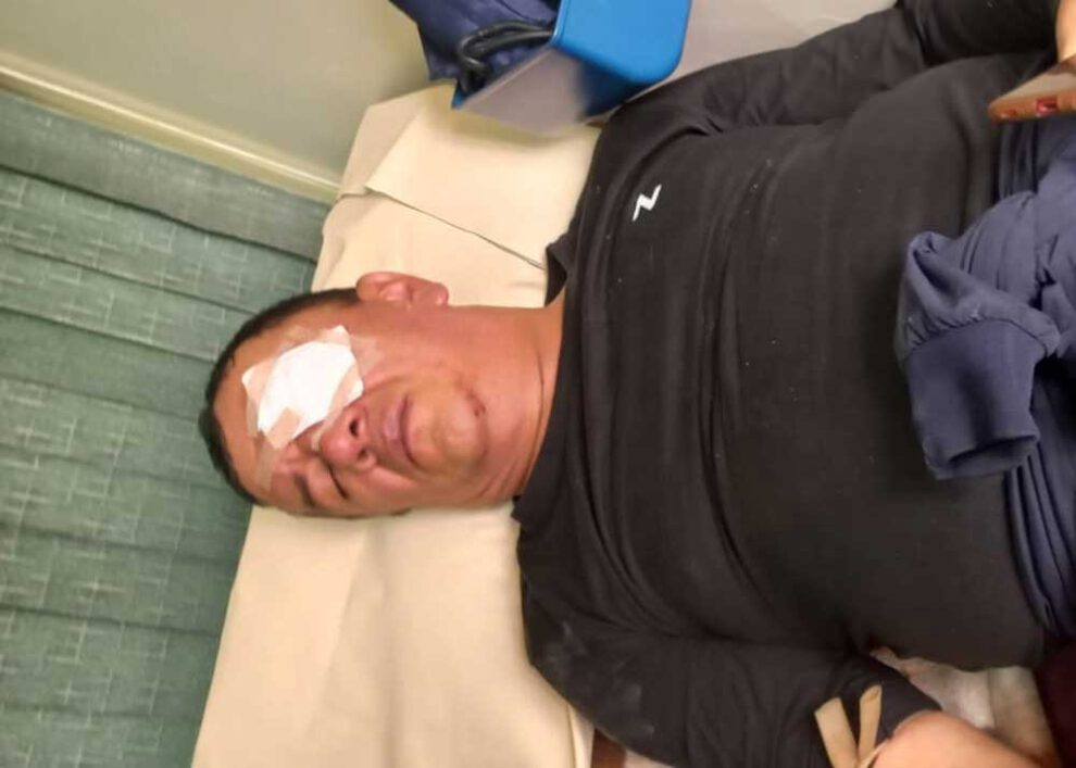 Profesor herido por la Policía en Roboré