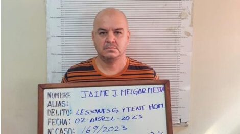 Captura de Jaime Melgar por golpiza a un taxista en Santa Cruz