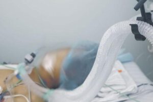 Fallece primer paciente con fiebre amarilla en Santa Cruz
