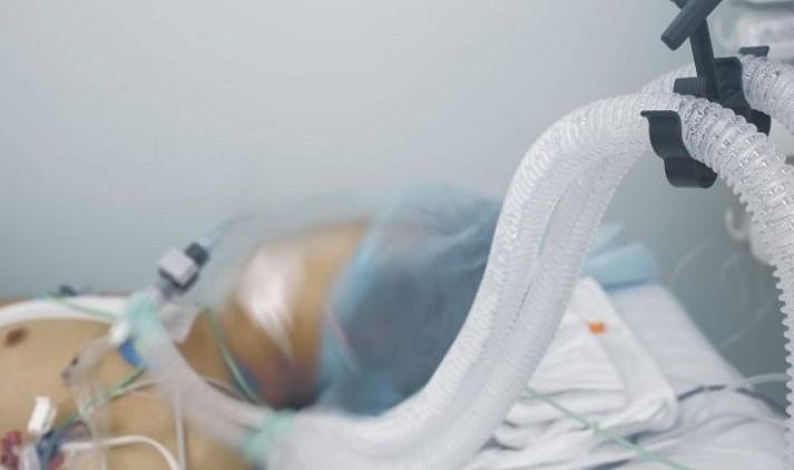 Fallece primer paciente con fiebre amarilla en Santa Cruz