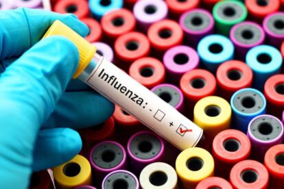 Influenza tipo A en Bolivia