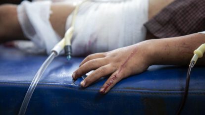 Persecución policial que termina con niño herido en Santa Cruz
