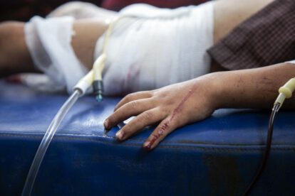 Persecución policial que termina con niño herido en Santa Cruz