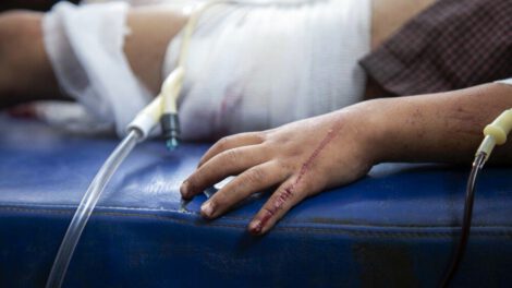 Persecución policial que termina con niño herido en Santa Cruz