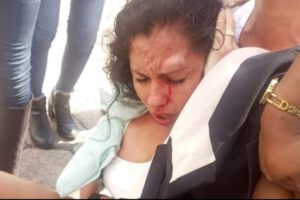 Muriel Cruz agredida durante protesta en Santa Cruz