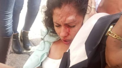 Muriel Cruz agredida durante protesta en Santa Cruz