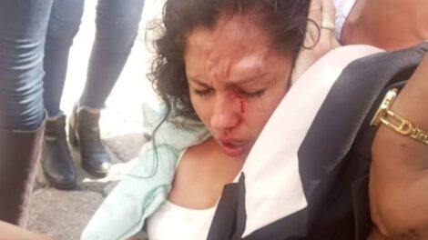 Muriel Cruz agredida durante protesta en Santa Cruz