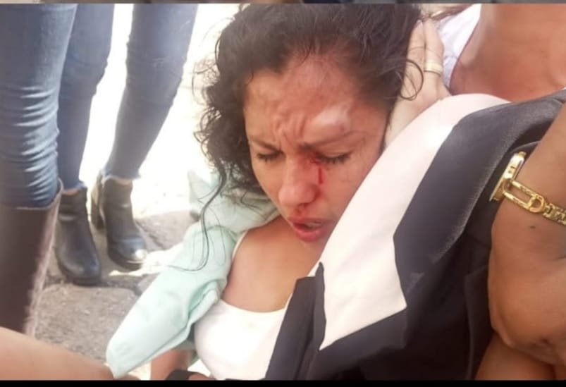 Muriel Cruz agredida durante protesta en Santa Cruz