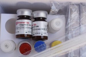 Entregan pruebas rápidas del Chagas a laboratorios del departamento