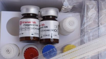 Entregan pruebas rápidas del Chagas a laboratorios del departamento