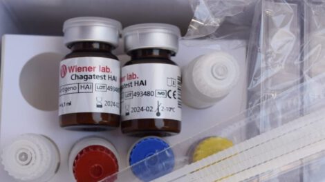Entregan pruebas rápidas del Chagas a laboratorios del departamento
