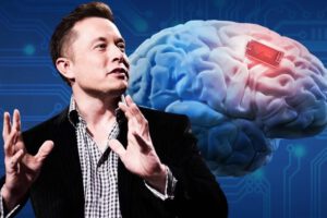 Implantes de chips en el cerebro para mejorar la salud