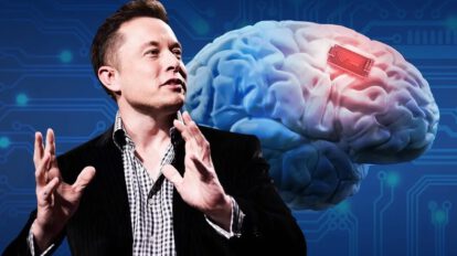 Implantes de chips en el cerebro para mejorar la salud