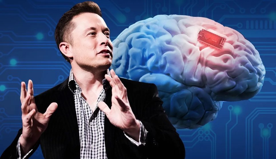 Implantes de chips en el cerebro para mejorar la salud