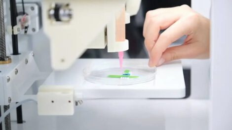 Pluma de impresión 3D para curación de heridas