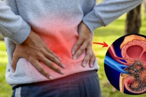 Alerta por cáncer de riñón: síntomas a los que debes prestar atención