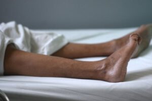 síndrome de Guillain-Barré es una enfermedad autoinmune
