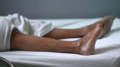 síndrome de Guillain-Barré es una enfermedad autoinmune