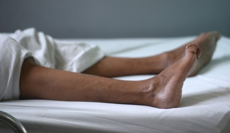 síndrome de Guillain-Barré es una enfermedad autoinmune