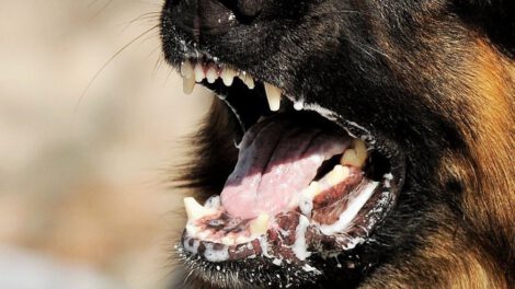 Imagen ilustrativa de una niña en estado grave tras ser mordida por perro con rabia