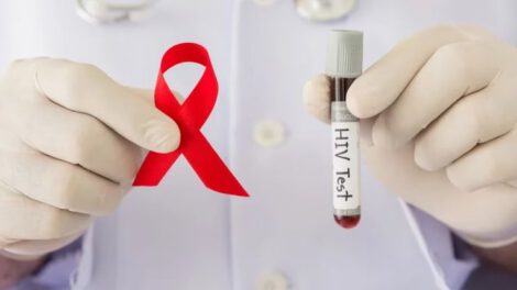 Alarmante incremento en diagnósticos de VIH-Sida en Chuquisaca