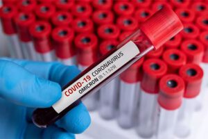 Variante EG.5.1 del Covid en 45 países