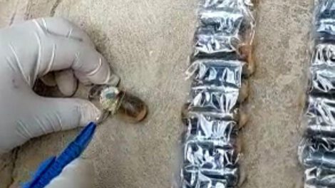 Cápsula de cocaína explota en el organismo de un joven