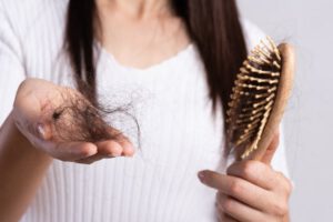 Falta de vitamina B7 y su impacto en la caída del cabello