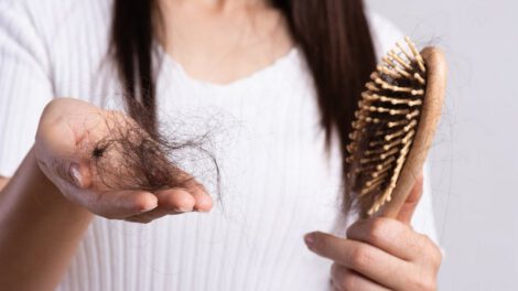Falta de vitamina B7 y su impacto en la caída del cabello