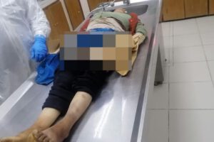 Informe forense confirma las lesiones mortales en caso de feminicidio en Oruro