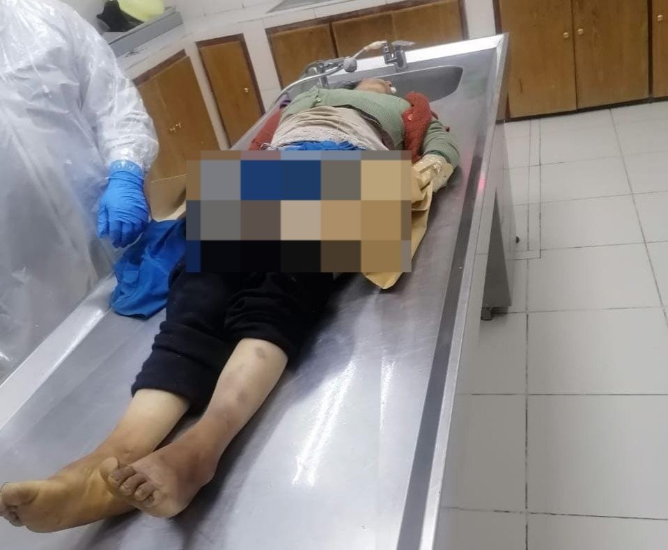 Informe forense confirma las lesiones mortales en caso de feminicidio en Oruro
