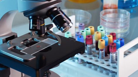 Terapia génica glioblastoma brinda esperanza contra glioblastoma mortal
