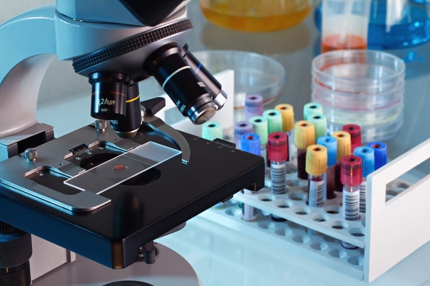 Terapia génica glioblastoma brinda esperanza contra glioblastoma mortal