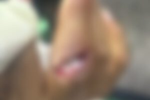 Niño fue mordido por un mono en el Zoológico Municipal