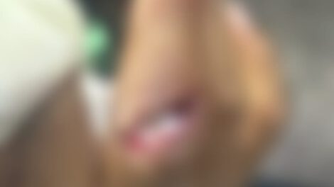 Niño fue mordido por un mono en el Zoológico Municipal
