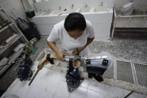 Prótesis accesibles en El Salvador: una esperanza para los amputados