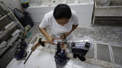 Prótesis accesibles en El Salvador: una esperanza para los amputados