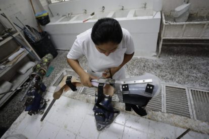 Prótesis accesibles en El Salvador: una esperanza para los amputados