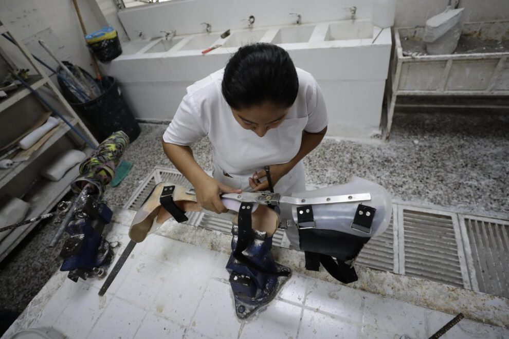Prótesis accesibles en El Salvador: una esperanza para los amputados
